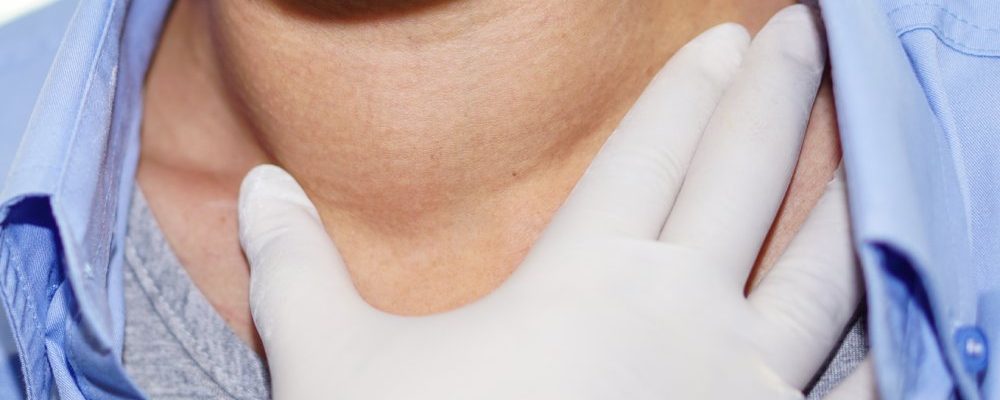 Asian lady woman patient have abnormal enlargement of thyroid gland Hyperthyroidism (overactive thyroid) at the throat : healthy strong medical concept