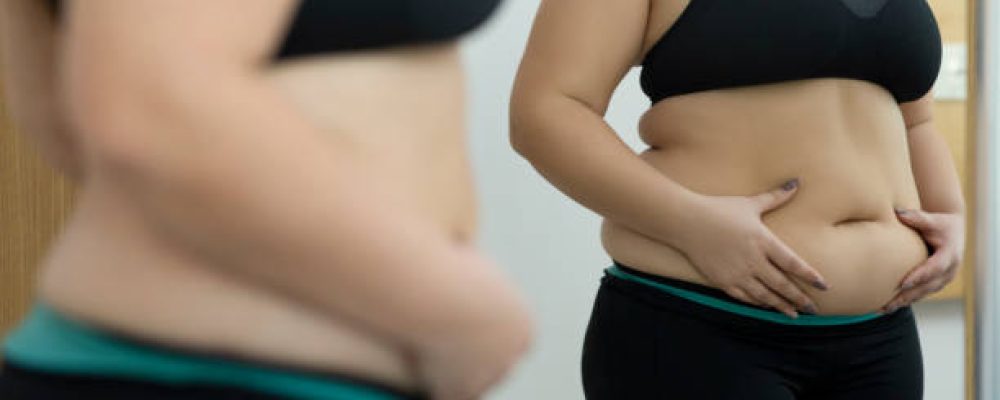 Woman with fat abdomen